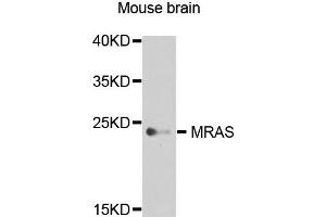Western blot analysis of extract of various cells, using MRAS antibody. (MRAS 抗体)