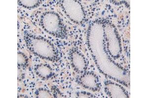 Used in DAB staining on fromalin fixed paraffin- embedded stomach tissue (SHBG 抗体  (AA 51-218))