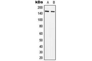 Western blot analysis of SLK expression in MCF7 (A), NIH3T3 (B) whole cell lysates. (SLK 抗体  (C-Term))
