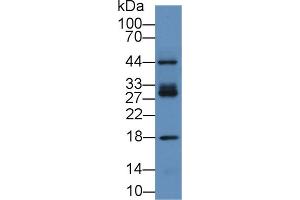 Detection of ICAM2 in Human Hela cell lysate using Polyclonal Antibody to Intercellular Adhesion Molecule 2 (ICAM2) (ICAM2 抗体  (AA 27-248))