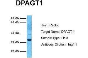 Host: Rabbit Target Name: DPAGT1 Sample Tissue: Human Hela Antibody Dilution: 1. (DPAGT1 抗体  (C-Term))