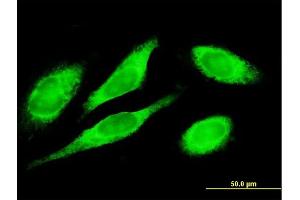 Immunofluorescence (IF) image for anti-Metadherin (MTDH) (AA 1-582) antibody (ABIN530089)