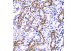Immunohistochemistry of paraffin-embedded rat kidney using ARRB1 antibody at dilution of 1:100 (400x lens). (beta Arrestin 1 抗体)
