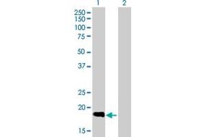 Western Blotting (WB) image for anti-Solute Carrier Family 11 (Proton-Coupled Divalent Metal Ion Transporters), Member 1 (SLC11A1) (AA 1-178) antibody (ABIN520254)