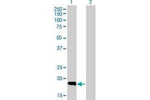Western Blot analysis of SLC11A1 expression in transfected 293T cell line by SLC11A1 MaxPab polyclonal antibody.