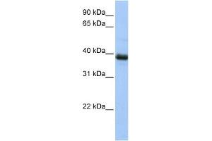 WB Suggested Anti-SPO11 Antibody Titration: 0. (SPO11 抗体  (N-Term))