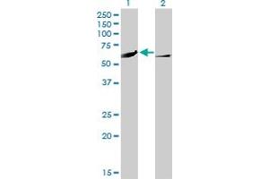 Western Blotting (WB) image for anti-Calcium/calmodulin-Dependent Protein Kinase IV (CAMK4) (AA 1-473) antibody (ABIN560153)