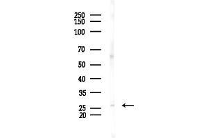 anti-Mannose-Binding Lectin (Protein C) 2, Soluble (MBL2) (N-Term) antibody