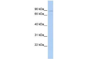 WB Suggested Anti-MEFV Antibody Titration:  0. (MEFV 抗体  (N-Term))