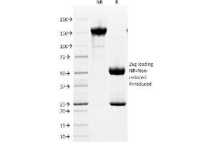 SDS-PAGE Analysis Purified CD2 Mouse Monoclonal Antibody (HuLy-m1). (CD2 抗体)
