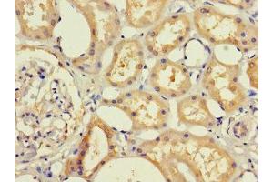 Immunohistochemistry of paraffin-embedded human kidney tissue using ABIN7145636 at dilution of 1:100 (RHD 抗体  (AA 32-76))
