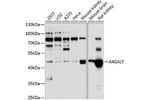 Western blot analysis of extracts of various cell lines, using GALT antibody (ABIN6131973, ABIN6136304, ABIN6136305 and ABIN6224802) at 1:1000 dilution. (A4GALT 抗体  (AA 244-353))