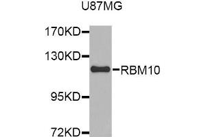 Western blot analysis of extracts of U87MG cell line, using RBM10 antibody.