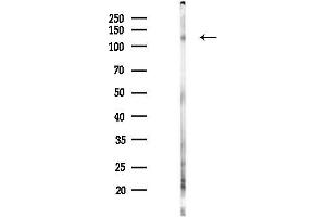 Western blot analysis of lysates from PC12 cells(LPS 4h treatment), using Phospho-VE-Cadherin (Tyr731) Antibody at 1/1000 dilution.