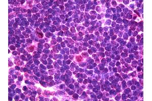 IHC Information: Paraffin embedded spleenlympho tissue, tested with an antibody dilution of 5 ug/ml. (NK2 Homeobox 3 抗体  (C-Term))