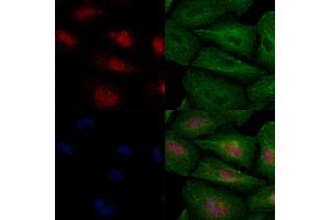 MKK3/MKK6 Antibody staining A549 cells by IF/ICC.
