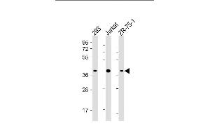 All lanes : Anti-HIF1AN Antibody (C-term) at 1:4000 dilution Lane 1: 293 whole cell lysate Lane 2: Jurkat whole cell lysate Lane 3: ZR-75-1 whole cell lysate Lysates/proteins at 20 μg per lane. (HIF1AN 抗体  (AA 1-349))