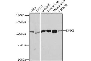 Western blot analysis of extracts of various cell lines, using eIF2C3 Rabbit mAb (ABIN7267039) at 1:1000 dilution.