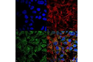 Immunocytochemistry/Immunofluorescence analysis using Rabbit Anti-BDNF Polyclonal Antibody . (BDNF 抗体  (N-Term))