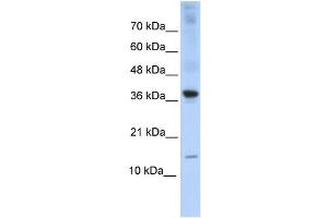 WB Suggested Anti-BATF Antibody Titration:  0. (BATF 抗体  (Middle Region))