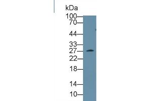 Western Blot; Sample: Mouse Serum; Primary Ab: 1µg/ml Rabbit Anti-Mouse CLTA Antibody Second Ab: 0. (CLTA 抗体  (AA 5-234))
