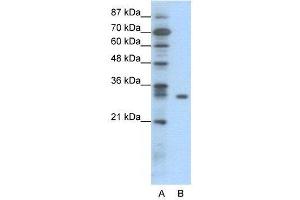WB Suggested Anti-NFKBIB  Antibody Titration: 0. (NFKBIB 抗体  (N-Term))