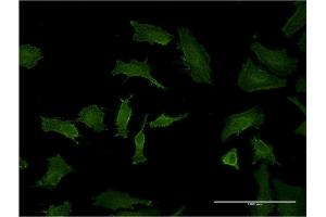 Immunofluorescence of monoclonal antibody to BID on HeLa cell. (BID 抗体  (AA 1-195))