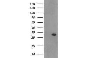 Western Blotting (WB) image for anti-Ras Association (RalGDS/AF-6) Domain Family Member 5 (RASSF5) antibody (ABIN1500615) (RASSF5 抗体)