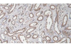 Immunohistochemistry (IHC) image for anti-Collagen, Type I, alpha 2 (COL1A2) (AA 1103-1366) antibody (ABIN7431329)