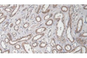 Detection of COL1a2 in Human Kidney Tissue using Polyclonal Antibody to Collagen Type I Alpha 2 (COL1a2) (COL1A2 抗体  (AA 1103-1366))
