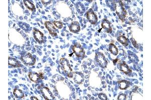 RGS6 antibody was used for immunohistochemistry at a concentration of 4-8 ug/ml to stain Epithelial cells of renal tubule (arrows) in Human Kidney. (RGS6 抗体  (C-Term))