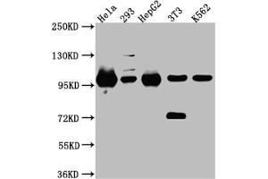 Western Blotting (WB) image for anti-Signal Transducer and Activator of Transcription 6, Interleukin-4 Induced (STAT6) antibody (ABIN7127828)