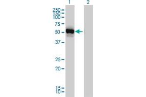 Western Blot analysis of GPT expression in transfected 293T cell line by GPT monoclonal antibody (M03), clone 4E2. (ALT 抗体  (AA 1-496))