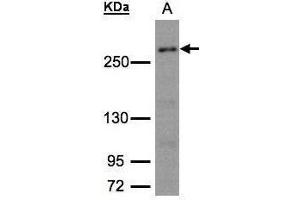 WB Image Sample (30μg whole cell lysate) A:293T whole cell lysate 5% SDS PAGE antibody diluted at 1:1500 (CAD 抗体  (C-Term))