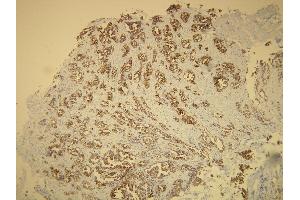 Immunohistochemistry (IHC) image for anti-Keratin 7 (KRT7) (AA 22-38), (N-Term) antibody (ABIN870436) (Cytokeratin 7 抗体  (N-Term))