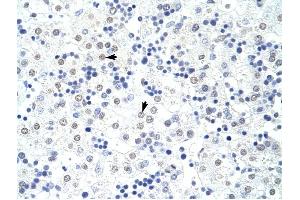 HNRPL antibody was used for immunohistochemistry at a concentration of 4-8 ug/ml to stain Hepatocytes (arrows) in Human Liver. (HNRNPL 抗体  (N-Term))