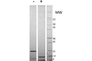 SDS-PAGE of Mouse Resistin Dimer Recombinant Protein SDS-PAGE of Mouse Resistin Dimer Recombinant Protein. (Resistin Dimer 蛋白)