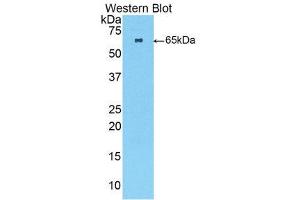 Western Blotting (WB) image for anti-Fast Skeletal Troponin C (TNNC2) (AA 2-160) antibody (ABIN1860813) (TNNC2 抗体  (AA 2-160))