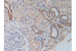 Figure. (MAPKAP Kinase 2 抗体  (AA 139-367))