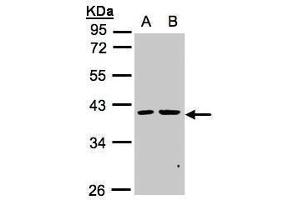 WB Image Sample(30 ug whole cell lysate) A:MOLT4 , B:Raji , 10% SDS PAGE antibody diluted at 1:1000 (PSKH2 抗体)