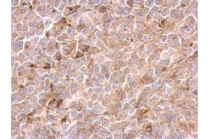 IHC-P Image Urokinase antibody detects PLAU protein at cytosol on H1299 xenograft by immunohistochemical analysis. (PLAU 抗体)