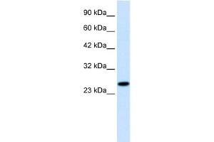 WB Suggested Anti-RGS13 Antibody Titration:  1. (RGS13 抗体  (Middle Region))