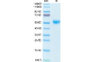 SDS-PAGE (SDS) image for T Cell Immunoreceptor with Ig and ITIM Domains (TIGIT) (AA 26-143) protein (Fc Tag) (ABIN7275732)