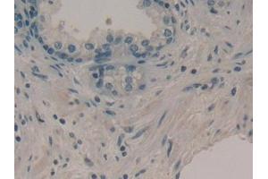 Detection of DKK1 in Human Prostate Tissue using Monoclonal Antibody to Dickkopf Related Protein 1 (DKK1) (DKK1 抗体  (AA 33-266))