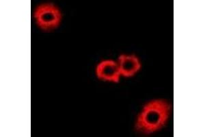 Immunofluorescent analysis of Fumarylacetoacetase staining in A549 cells. (FAH 抗体)