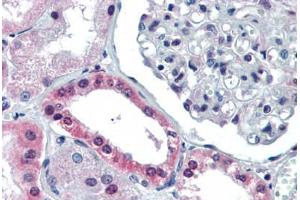 Human Kidney (formalin-fixed, paraffin-embedded) stained with PAX4 antibody ABIN462174 followed by biotinylated goat anti-rabbit IgG secondary antibody ABIN481713, alkaline phosphatase-streptavidin and chromogen. (PAX4 抗体  (AA 166-215))