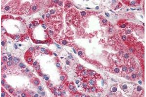 Human Kidney (formalin-fixed, paraffin-embedded) stained with PSPH antibody ABIN364329 at 10 ug/ml followed by biotinylated anti-mouse IgG secondary antibody ABIN481714, alkaline phosphatase-streptavidin and chromogen. (PSPH 抗体  (AA 1-225))