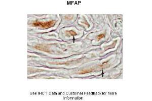 Sample Type :  Mouse sciatic nerve  Primary Antibody Dilution :  1:500  Secondary Antibody :  Biotinylated Anti-Rabbit 1:1000 followed by avidin-biotin and diaminobenzidine  Secondary Antibody Dilution :  1:1000  Gene Name :  MFAP4  Submitted by :  Beth Friedman, Ph. (MFAP4 抗体  (N-Term))
