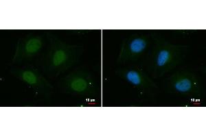 ICC/IF Image PSKH2 antibody [N2C3] detects PSKH2 protein at nucleus by immunofluorescent analysis. (PSKH2 抗体)