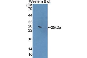 Western blot analysis of the recombinant protein. (FNBP1 抗体  (AA 348-529))